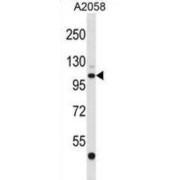 ER Degradation-Enhancing Alpha-Mannosidase-Like Protein 3 (EDEM3) Antibody