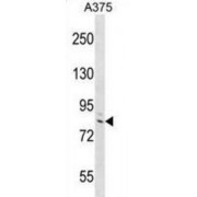 Differentially Expressed In FDCP 6 Homolog (DEF6) Antibody