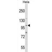 SH3 And PX Domains 2A (SH3PXD2A) Antibody