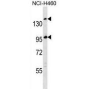 Western blot analysis of extracts of  NCI-H460 cell lysates using SSC5D antibody (35 µg/lane).