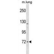 Formin Binding Protein 1-Like (FNBP1L) Antibody