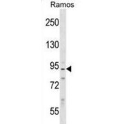 Neurabin-2 (PPP1R9B) Antibody