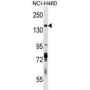 Diaphanous Homolog 3 (Drosophila) (DIAPH3) Antibody