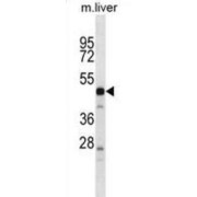 Thymus-Specific Serine Protease (PRSS16) Antibody