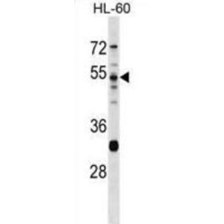 Thymus-Specific Serine Protease (PRSS16) Antibody