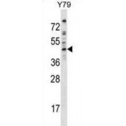 Western blot analysis of extract of Y79 cell lysates using EPB49 antibody (35 µg/lane).