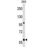 Transmembrane And Coiled-Coil Domain-Containing Protein 4 (TMCO4) Antibody