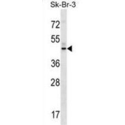 G Protein-Coupled Receptor 87 (GPR87) Antibody