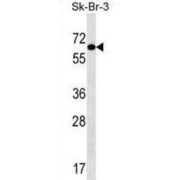 Thyroid Hormone Receptor Interactor 4 (TRIP4) Antibody