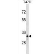 Dynein Axonemal Light Intermediate Chain 1 (DNALI1) Antibody