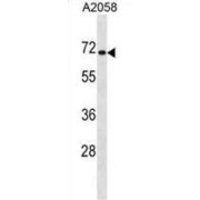 Cytoplasmic Polyadenylation Element Binding Protein 1 (CPEB1) Antibody