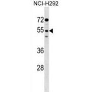 Signal Regulatory Protein Gamma (SIRPG) Antibody