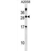 Phospholipase A2, Group XIIA (PLA2G12A) Antibody