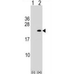 Phospholipase A2, Group XIIA (PLA2G12A) Antibody