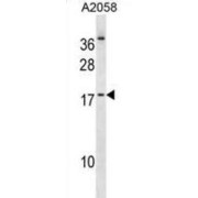 Helix Loop Helix Protein 2 (NHLH2) Antibody