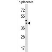 Retinal Pigment Epithelium-Derived Rhodopsin Homolog (RRH) Antibody