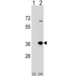 Sulfotransferase Family 1B Member 1 (SULT1B1) Antibody