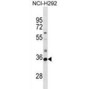 Sulfotransferase Family 2A Member 1 (SULT2A1) Antibody