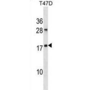 ADP-Ribosylation Factor-Like Protein 2 (ARL2) Antibody