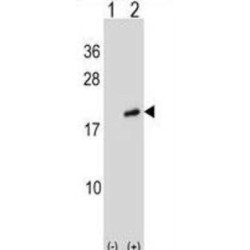 ADP-Ribosylation Factor-Like Protein 2 (ARL2) Antibody