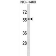 Sialic Acid Binding Ig Like Lectin 5 (SIGLEC5) Antibody