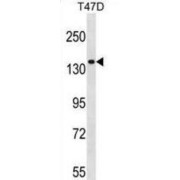 Myosin IE (MYO1E) Antibody