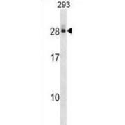 Deoxycytidylate Deaminase (DCTD) Antibody