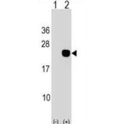 Deoxycytidylate Deaminase (DCTD) Antibody