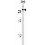 Cell Division Cycle Associated 4 (CDCA4) Antibody