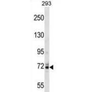 Potassium Voltage-Gated Channel Subfamily C Member 4 (KCNC4) Antibody