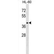 Alpha-2,8-Sialyltransferase 8F (ST8SIA6) Antibody