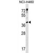 Ubiquitin-Conjugating Enzyme E2 U (UBE2U) Antibody