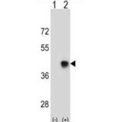 Spermatid Maturation Protein 1 (SPEM1) Antibody