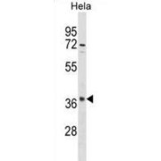 Olfactory Receptor 10S1 (OR10S1) Antibody