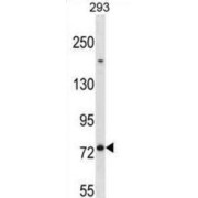 Mediator Complex Subunit 16 (MED16) Antibody
