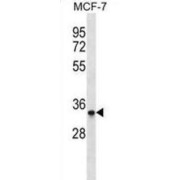 MAD2L1 Binding Protein (MAD2L1BP) Antibody