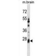 BTB/POZ Domain-Containing Protein KCTD6 (KCTD6) Antibody