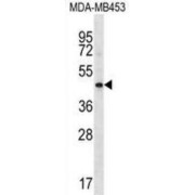 Hyaluronan And Proteoglycan Link Protein 3 (HAPLN3) Antibody