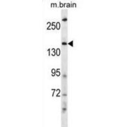 HECT, C2 And WW Domain Containing E3 Ubiquitin Protein Ligase 2 (HECW2) Antibody