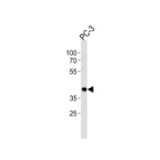 Cyclic AMP-Responsive Element Binding Protein 3-Like Protein 4 (CREB3L4) Antibody