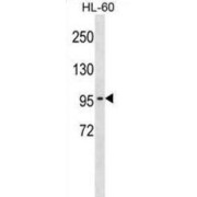 Chloride Channel Protein 2 (CLCN2) Antibody