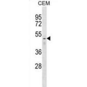 Farnesyltransferase Beta (FNTB) Antibody