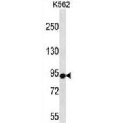 Cold Shock Domain Containing Protein E1 (CSDE1) Antibody