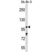 Ubiquitin Carboxyl-Terminal Hydrolase 16 (USP16) Antibody