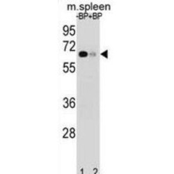 Ankyrin Repeat And SOCS Box Containing 3 (ASB3) Antibody