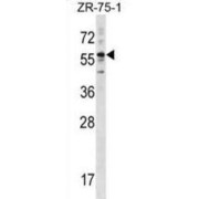 Keratin, Type II Cytoskeletal 3 (KRT3) Antibody