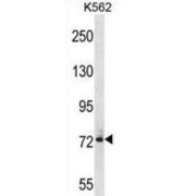 Dynein Intermediate Chain 1, Axonemal (DNAI1) Antibody