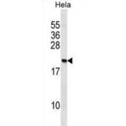 Polyadenylate-Binding Protein-Interacting Protein 2 (PAIP2) Antibody