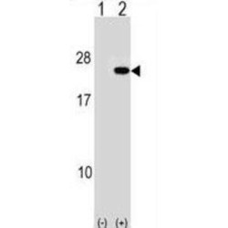 Polyadenylate-Binding Protein-Interacting Protein 2 (PAIP2) Antibody