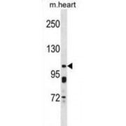 Potassium Voltage-Gated Channel Subfamily Q Member 5 (KCNQ5) Antibody